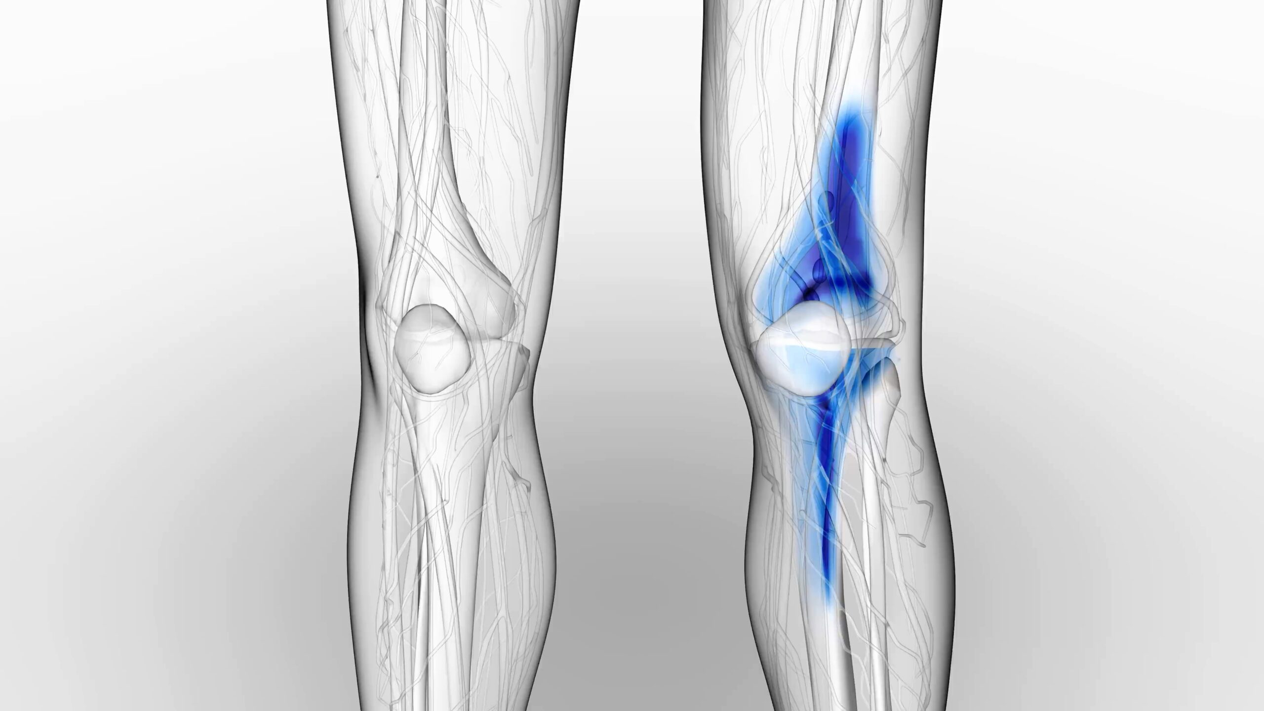 Acupuncture Works For Knee Pain [Video] ACCESS ACUPUNCTURE